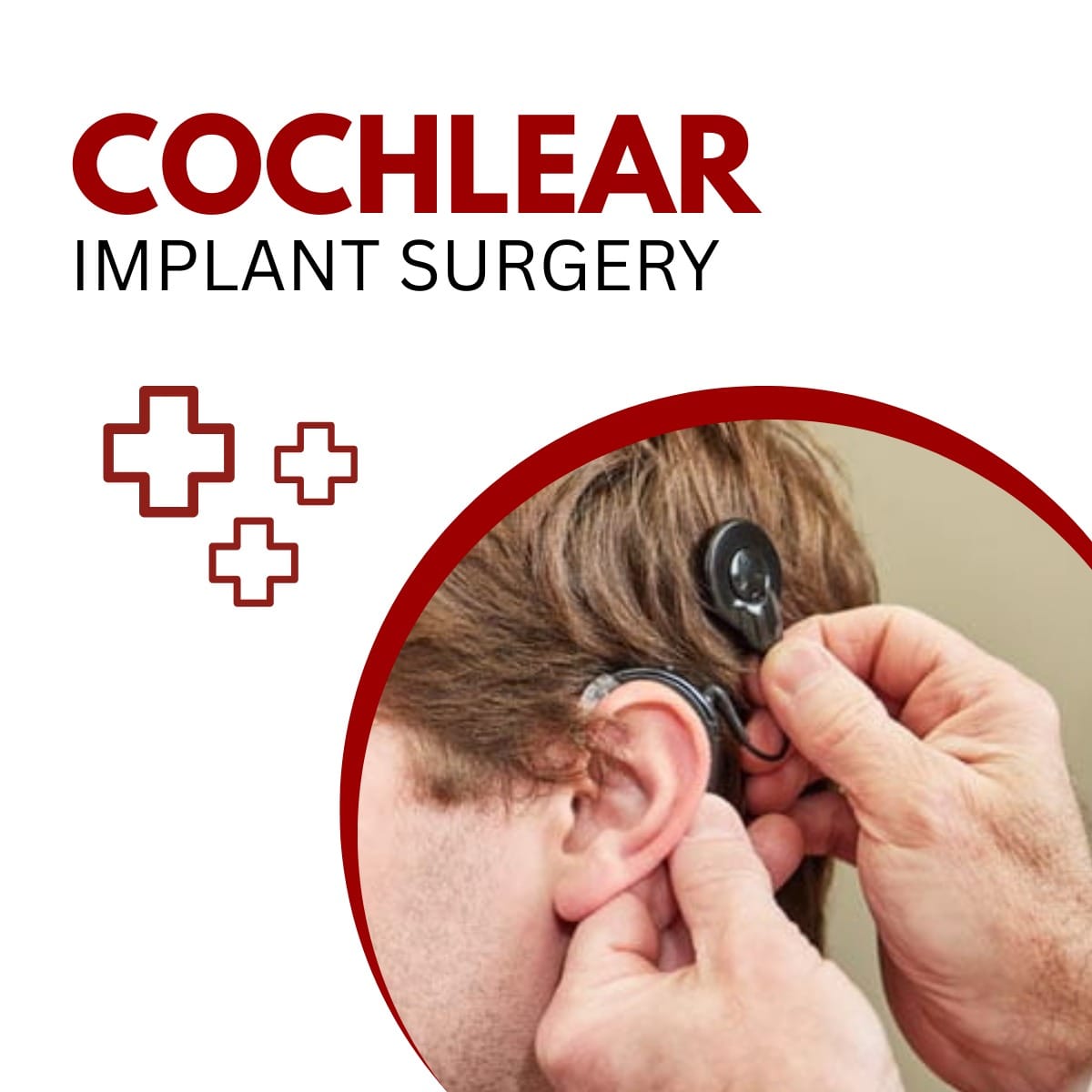 Cochlear Implant Surgery
