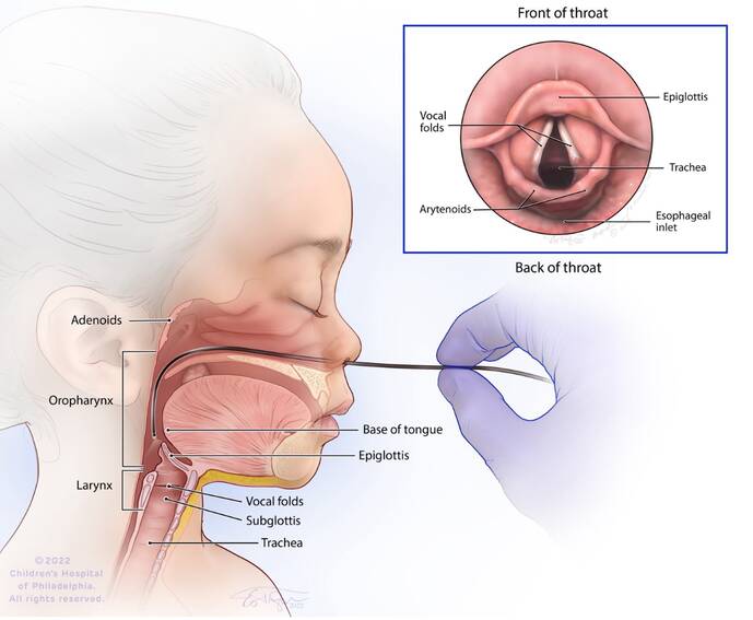 Voice Disorder Management